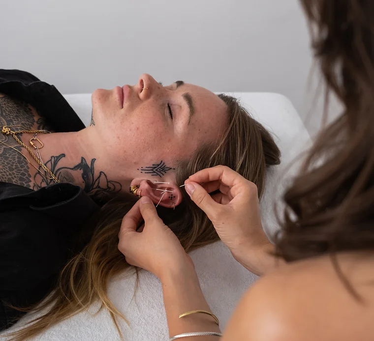 Ohrakupunktur-Behandlung in der Naturheilpraxis Amber Schimpf Köln